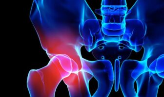 La IA puede ayudar a comprender mejor el dolor crónico